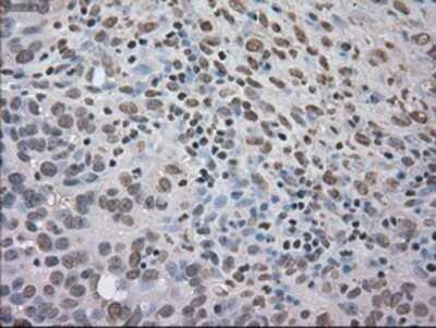 Immunohistochemistry: TrkC Antibody (OTI2B8) - Azide and BSA Free [NBP2-74626]