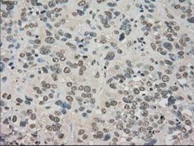 Immunohistochemistry: TrkC Antibody (OTI2B8) - Azide and BSA Free [NBP2-74626]