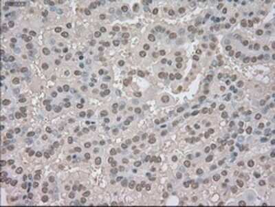 Immunohistochemistry: TrkC Antibody (OTI2B8) - Azide and BSA Free [NBP2-74626]