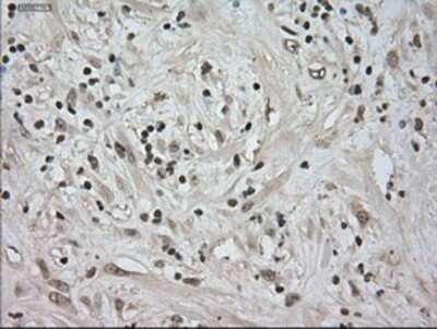 Immunohistochemistry: TrkC Antibody (OTI2B8) - Azide and BSA Free [NBP2-74626]