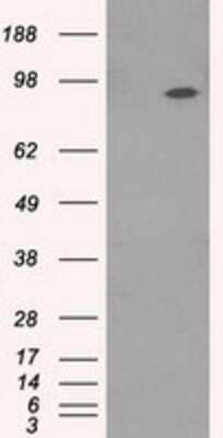 Western Blot: TrkC Antibody (OTI2B8)Azide and BSA Free [NBP2-74626]