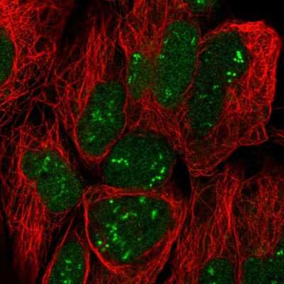 Immunocytochemistry/ Immunofluorescence: Trophinin Antibody [NBP2-58739]