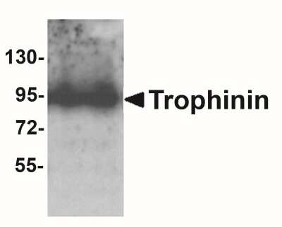 Western Blot: Trophinin AntibodyBSA Free [NBP2-41320]