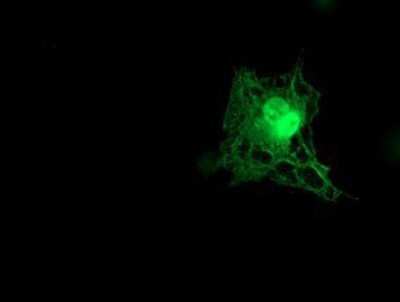 Immunocytochemistry/ Immunofluorescence: Tropomodulin 1 Antibody (OTI2C2) [NBP2-00955]