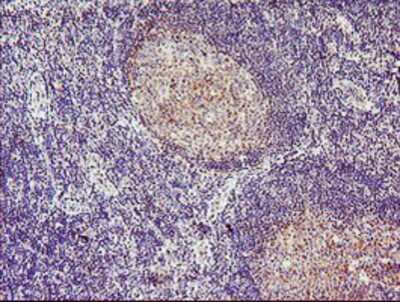 Immunohistochemistry-Paraffin: Tropomodulin 1 Antibody (OTI2C2) [NBP2-00955]