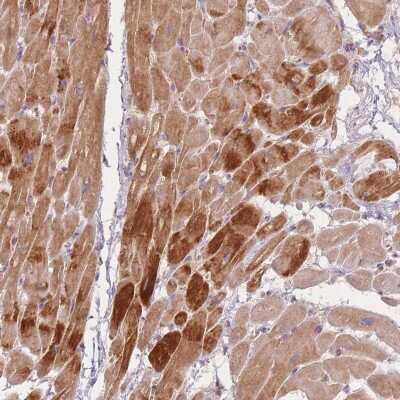 Immunohistochemistry-Paraffin: Tropomodulin 1 Antibody [NBP2-13459]