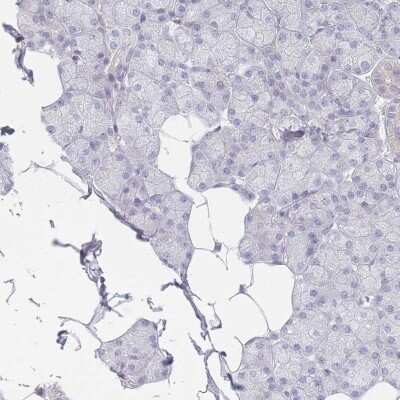 Immunohistochemistry-Paraffin: Tropomodulin 1 Antibody [NBP2-13459]