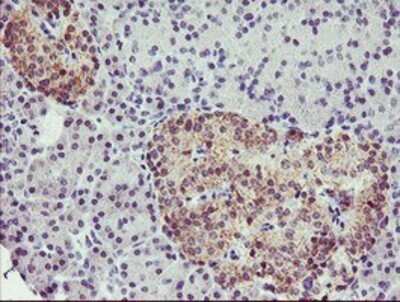 Immunohistochemistry: Tropomodulin 1 Antibody (OTI2C2) - Azide and BSA Free [NBP2-74632]
