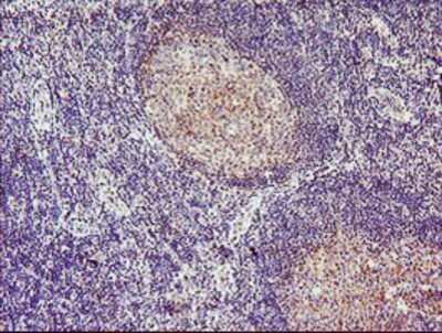 Immunohistochemistry: Tropomodulin 1 Antibody (OTI2C2) - Azide and BSA Free [NBP2-74632]