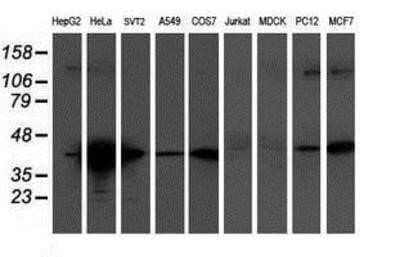 Western Blot: Tropomodulin 1 Antibody (OTI2C2)Azide and BSA Free [NBP2-74632]