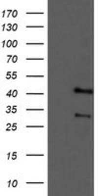 Western Blot: Tropomodulin 1 Antibody (OTI2C2)Azide and BSA Free [NBP2-74632]