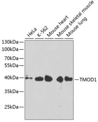 Western Blot: Tropomodulin 1 AntibodyBSA Free [NBP2-94879]