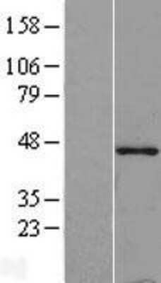 Western Blot: Tropomodulin 1 Overexpression Lysate [NBL1-17115]