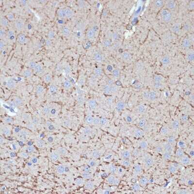 Immunohistochemistry-Paraffin: Tropomodulin 2 Antibody (5E7G5) [NBP3-15905]
