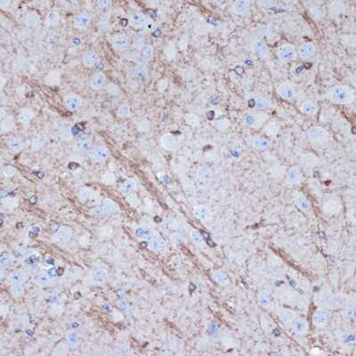 Immunohistochemistry-Paraffin: Tropomodulin 2 Antibody (5E7G5) [NBP3-15905]