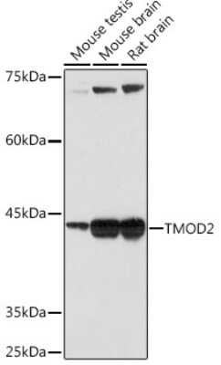 Western Blot: Tropomodulin 2 Antibody (5E7G5) [NBP3-15905]