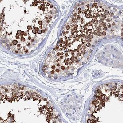 Immunohistochemistry-Paraffin: Tropomodulin 2 Antibody [NBP1-87378]