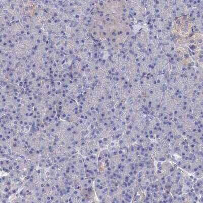 Immunohistochemistry-Paraffin: Tropomodulin 2 Antibody [NBP1-87378]