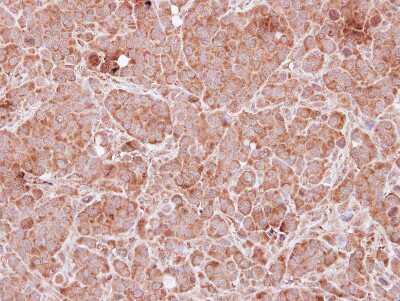 Immunohistochemistry-Paraffin: Tropomodulin 2 Antibody [NBP2-20730]