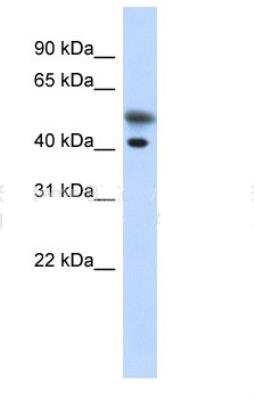 Western Blot: Tropomodulin 2 Antibody [NBP1-79572]