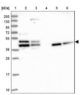 Western Blot: Tropomodulin 2 Antibody [NBP1-87378]