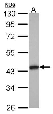 Western Blot: Tropomodulin 2 Antibody [NBP2-20729]