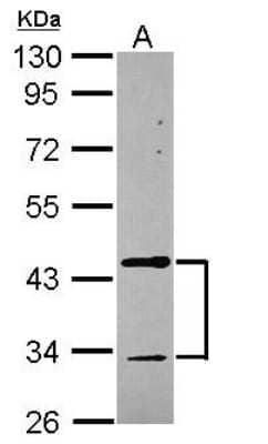 Western Blot: Tropomodulin 2 Antibody [NBP2-20730]