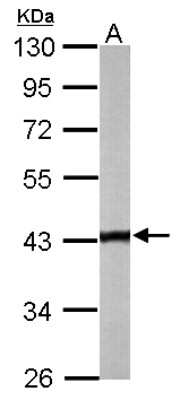 Western Blot: Tropomodulin 2 Antibody [NBP2-20730]