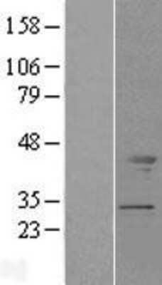 Western Blot: Tropomodulin 2 Overexpression Lysate [NBL1-17116]