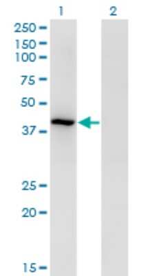 Western Blot: Tropomodulin 3 Antibody (1E1) [H00029766-M10]