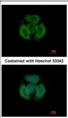Immunocytochemistry/ Immunofluorescence: Tropomodulin 3 Antibody [NBP2-20731]