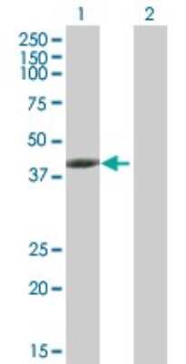 Western Blot: Tropomodulin 3 Antibody [H00029766-B01P]