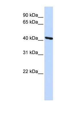 Western Blot: Tropomodulin 3 Antibody [NBP1-56652]