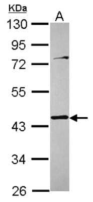 Western Blot: Tropomodulin 3 Antibody [NBP2-20731]