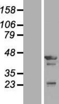 Western Blot: Tropomodulin 3 Overexpression Lysate [NBL1-17117]