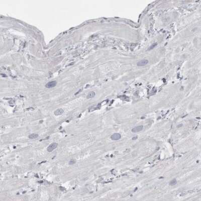 Immunohistochemistry-Paraffin: Tropomodulin 4 Antibody [NBP1-80745]