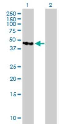 Western Blot: Tropomodulin 4 Antibody [H00029765-B01P]