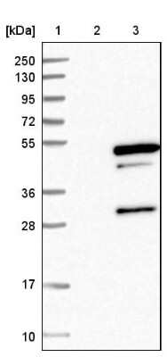 Western Blot: Tropomodulin 4 Antibody [NBP1-80745]