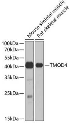 Western Blot: Tropomodulin 4 AntibodyBSA Free [NBP2-95207]