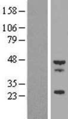 Western Blot: Tropomodulin 4 Overexpression Lysate [NBL1-17118]