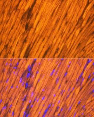 Immunohistochemistry: Tropomyosin-1 Antibody (5Q2H6) [NBP3-16689]