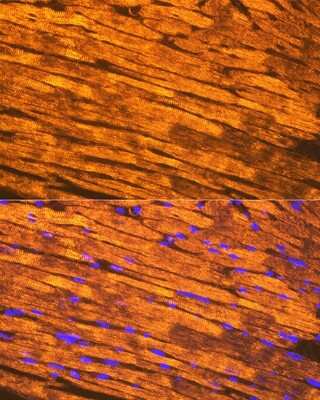 Immunohistochemistry: Tropomyosin-1 Antibody (5Q2H6) [NBP3-16689]