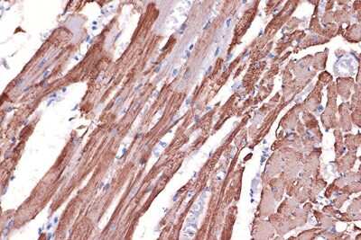 Immunohistochemistry-Paraffin: Tropomyosin-1 Antibody (5Q2H6) [NBP3-16689]