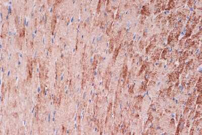 Immunohistochemistry-Paraffin: Tropomyosin-1 Antibody (5Q2H6) [NBP3-16689]