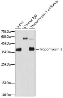 Immunoprecipitation: Tropomyosin-1 Antibody (5Q2H6) [NBP3-16689]