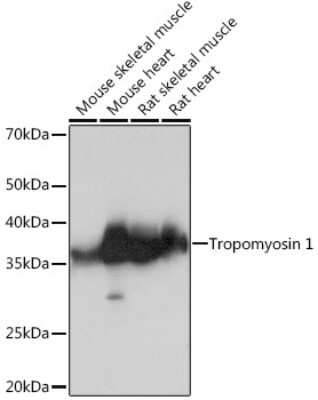 Western Blot: Tropomyosin-1 Antibody (5Q2H6) [NBP3-16689]