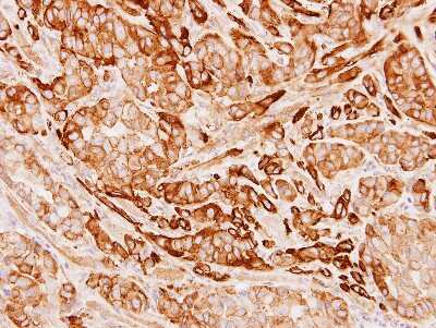 Immunohistochemistry-Paraffin: Tropomyosin-1 Antibody [NBP1-33716]