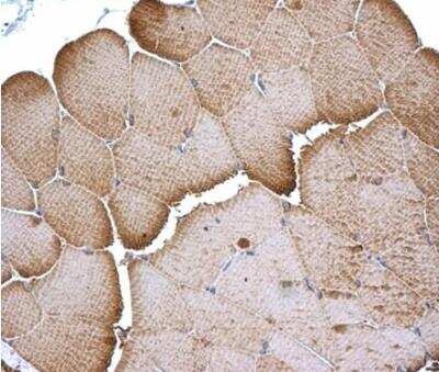 Immunohistochemistry-Paraffin: Tropomyosin-1 Antibody [NBP1-33716]