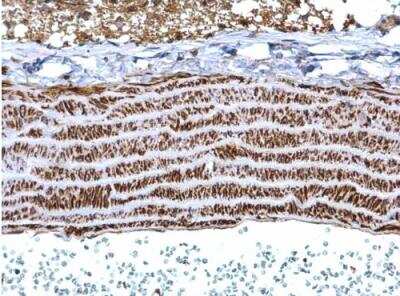 Immunohistochemistry-Paraffin: Tropomyosin-1 Antibody [NBP1-33716]
