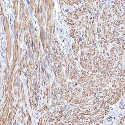 Immunohistochemistry-Paraffin: Tropomyosin-1 Antibody [NBP1-89896]